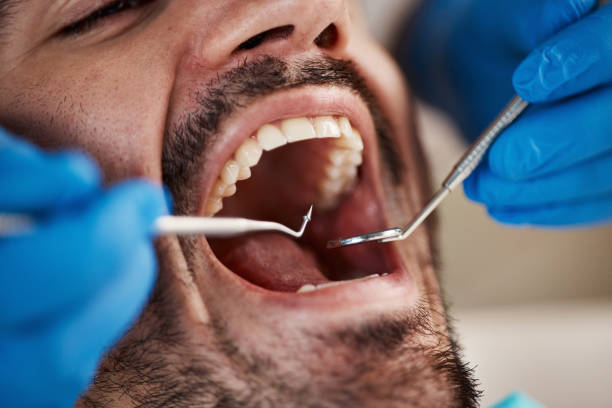 Best Pediatric Emergency Dentist in Sparks, TX